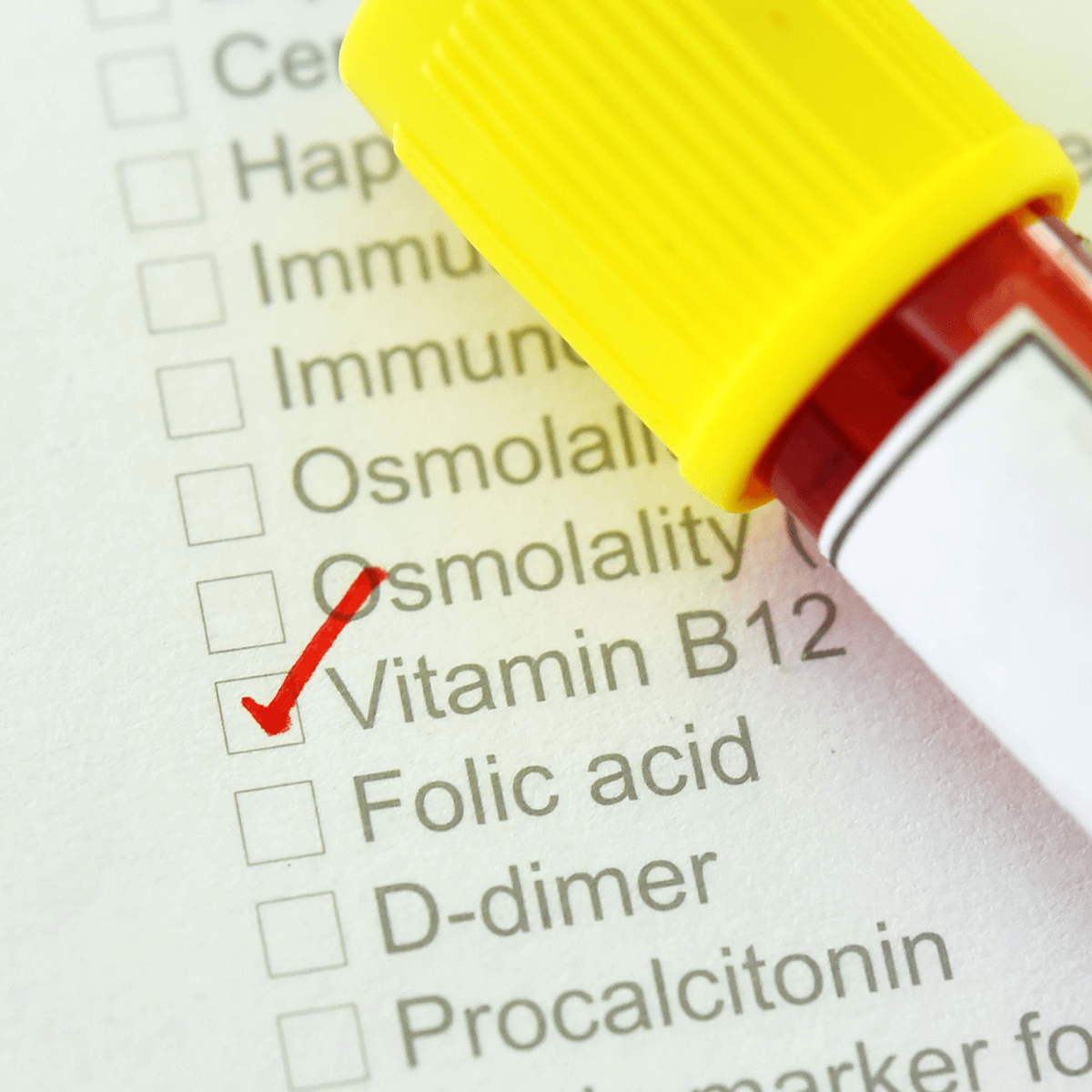 Image of checklist showing Vitamin B12 needed